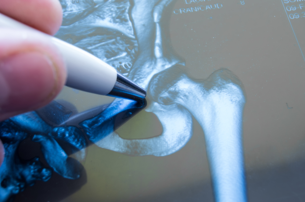 Medical Mistakes